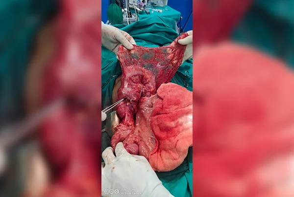 surgery