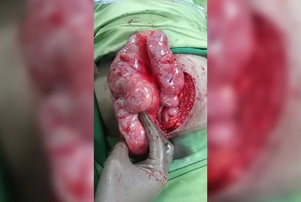 surgery