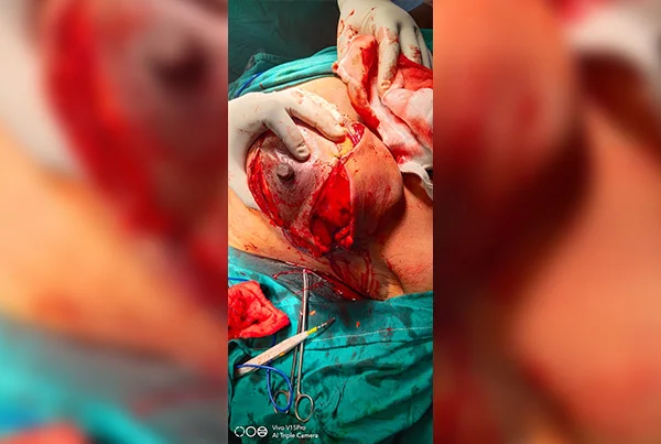 surgery